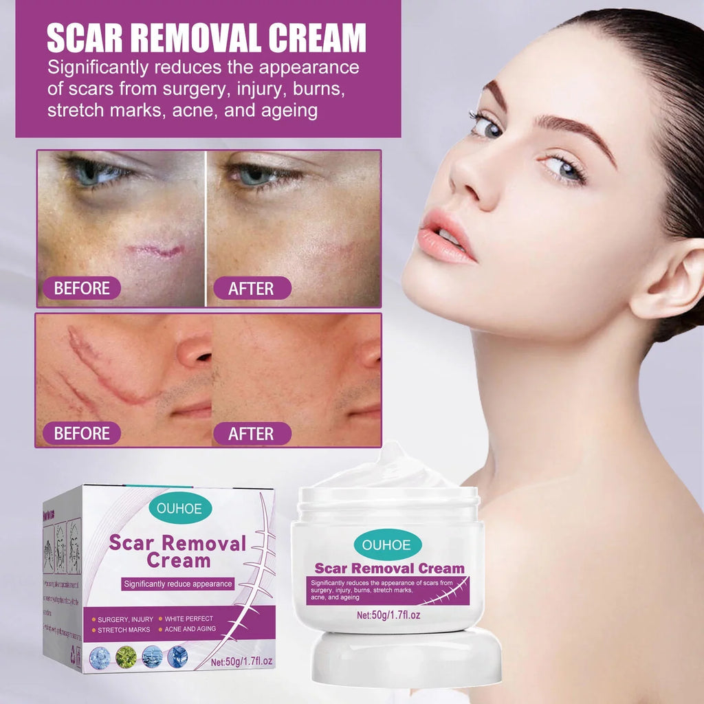 Scar Cream Removal Cream Scar Repair Skin and 2PCS Scar 50ml Removal Repair