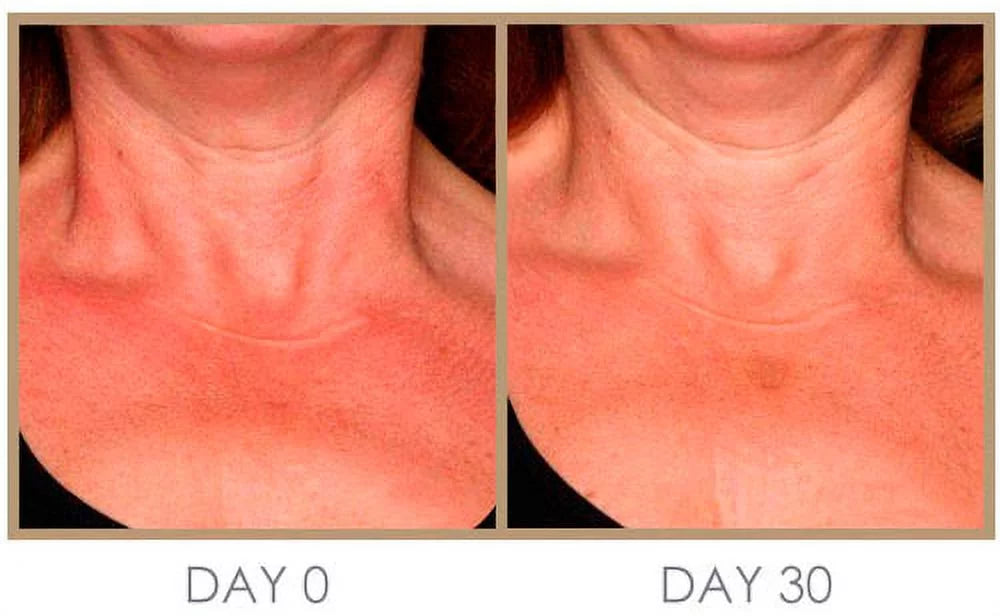 ml Cream, Night Moisturizing Treatment & Instant 50 & Day Dream Intense