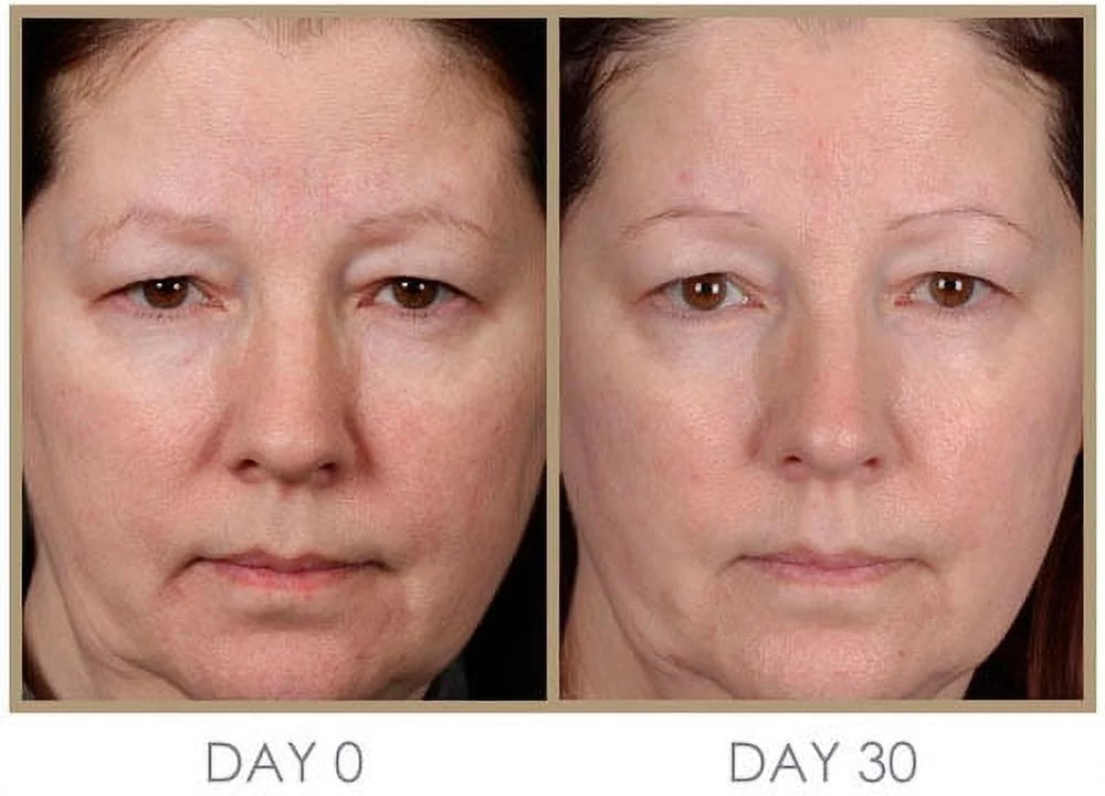 ml Cream, Night Moisturizing Treatment & Instant 50 & Day Dream Intense