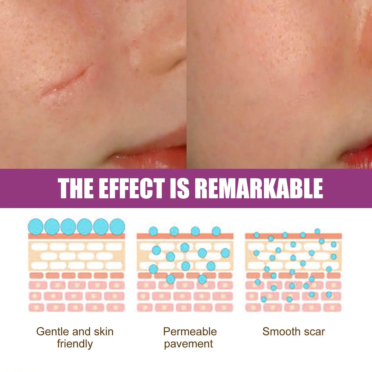 Scar Cream Removal Cream Scar Repair Skin and 2PCS Scar 50ml Removal Repair