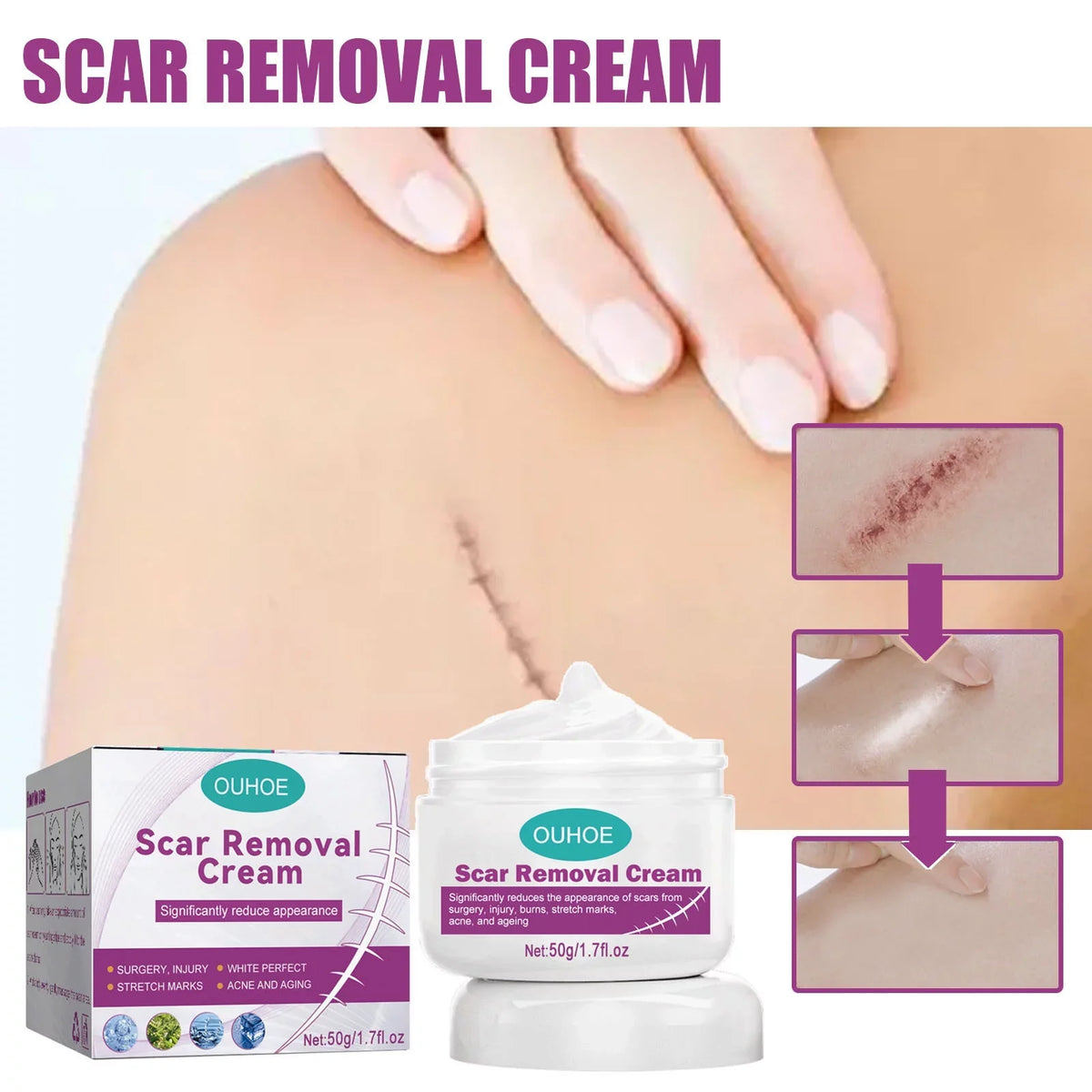 Scar Cream Removal Cream Scar Repair Skin and 2PCS Scar 50ml Removal Repair