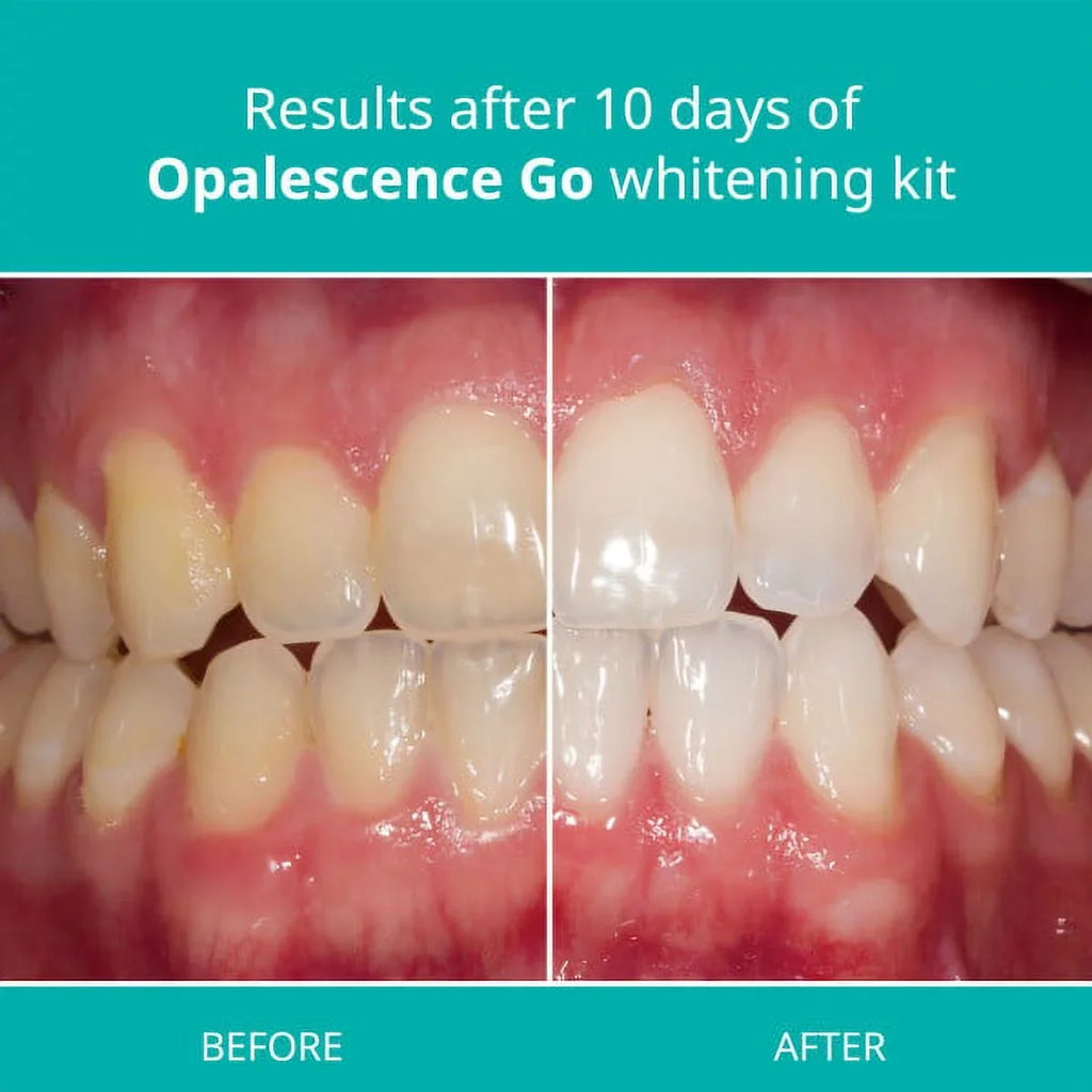 Opalescence Mint Go Opalescence Toothpaste Whitening Trays And 10%