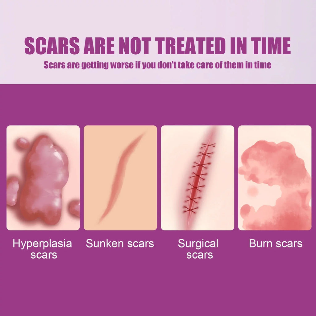 Scar Cream Removal Cream Scar Repair Skin and 2PCS Scar 50ml Removal Repair