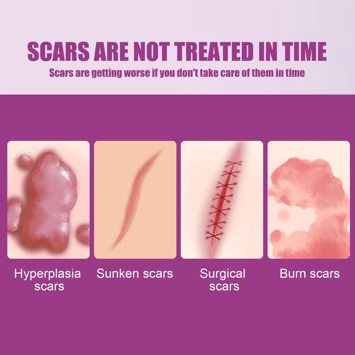 Scar Cream Removal Cream Scar Repair Skin and 2PCS Scar 50ml Removal Repair