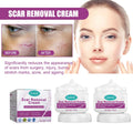 Scar Cream Removal Cream Scar Repair Skin and 2PCS Scar 50ml Removal Repair