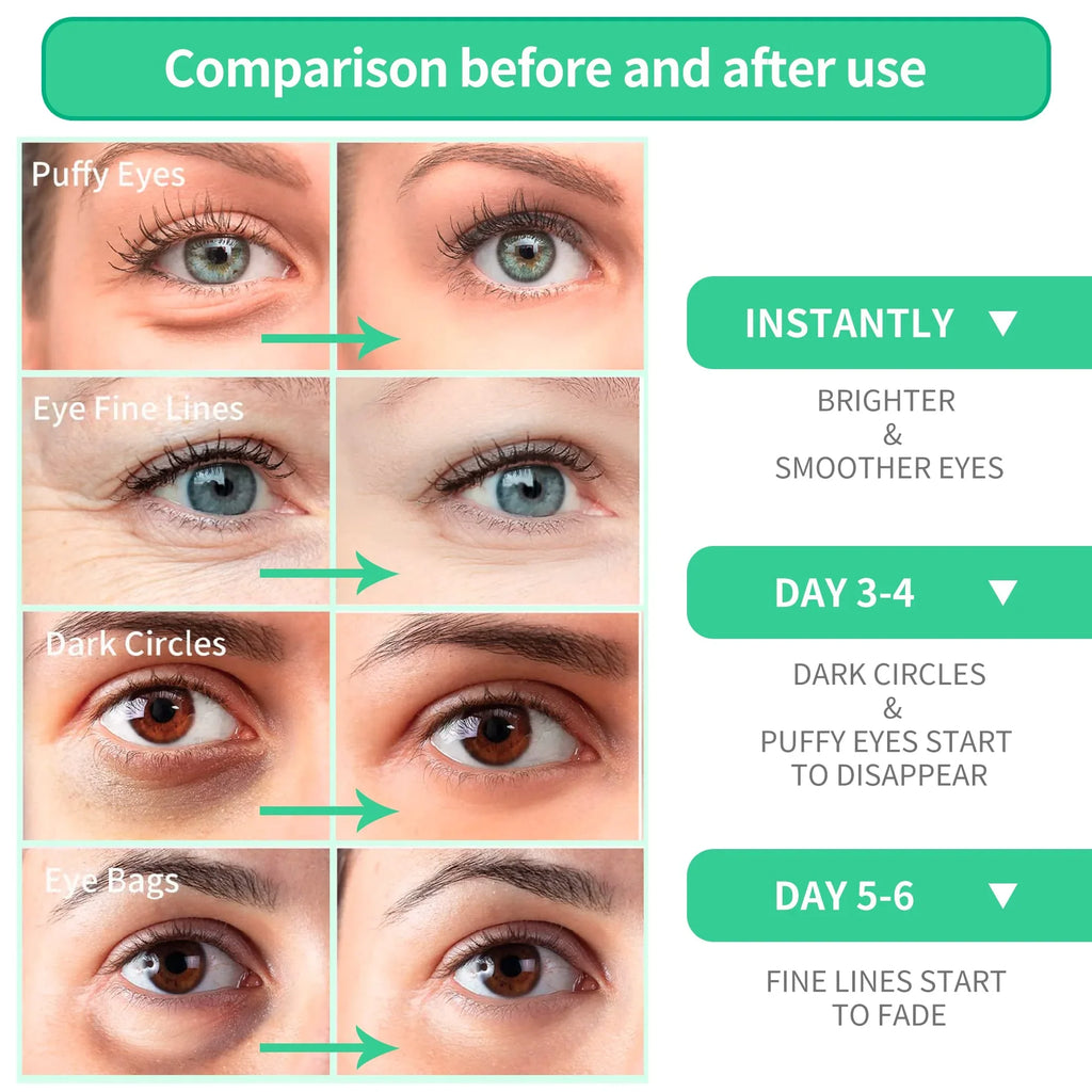 Vera Mask, Pairs Face for & Acid - 30 Collagen Eye Aloe Care Amino